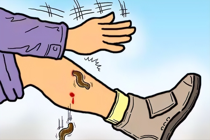 被蚂蟥吸住怎么办?教你有效自救的方法