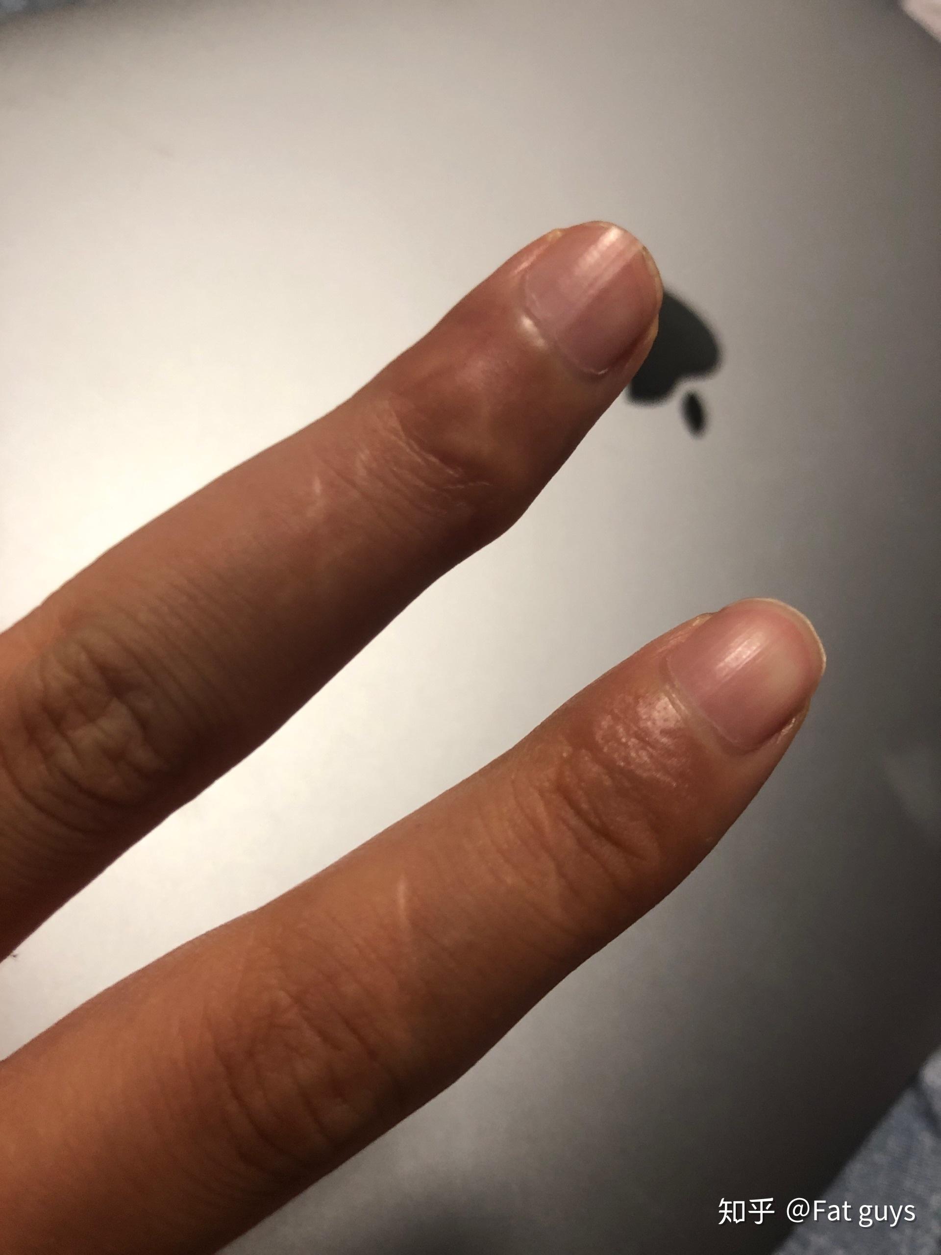 如何看待红花会成员贝贝在直播中剁手指的行为