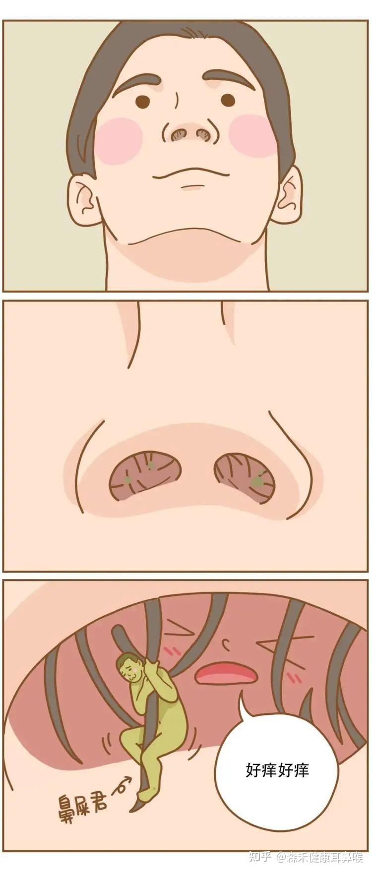 鼻腔表面黏膜图片