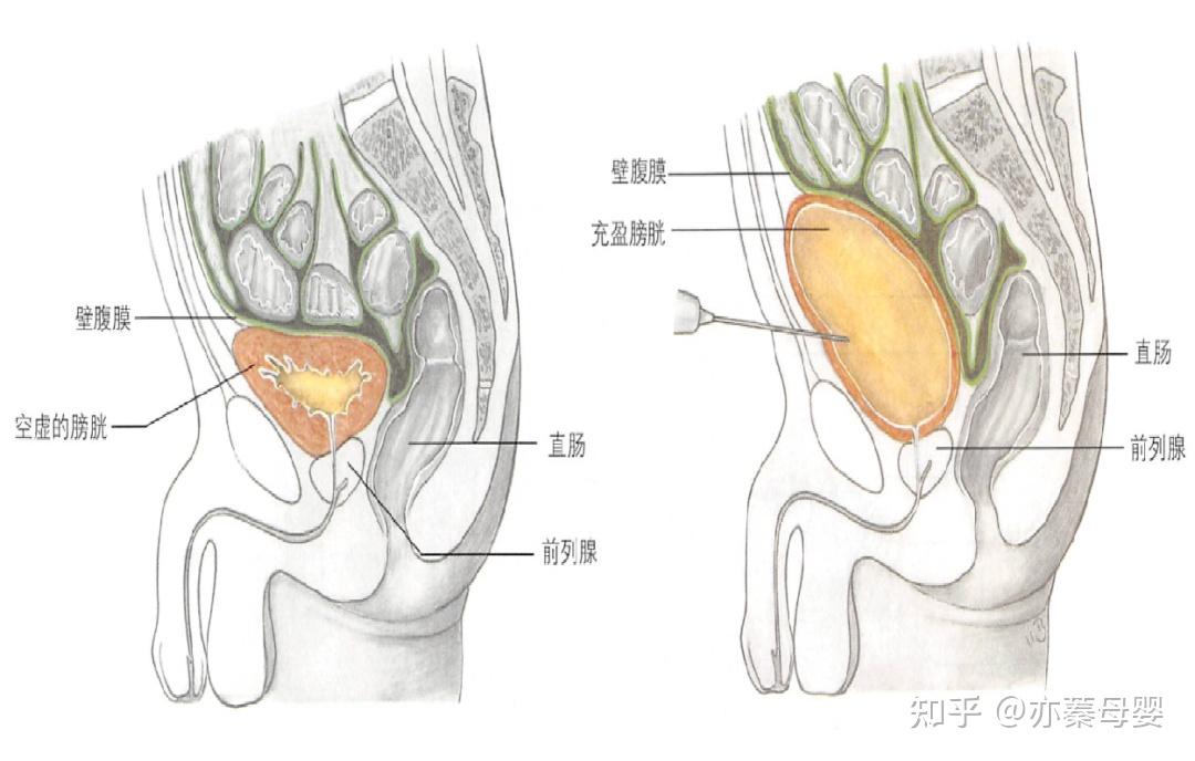 女性身体膀胱图片