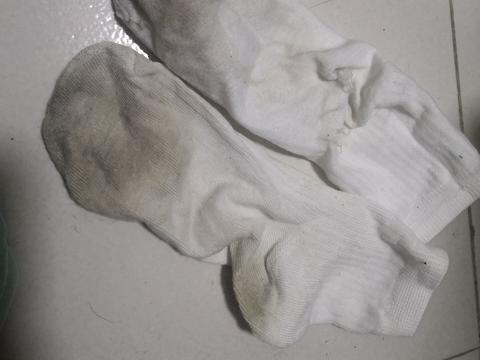 女孩子汗脚怎么办啊,在宿舍不敢脱鞋?