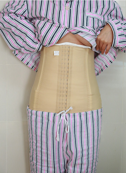 抽脂手术让您窈窕成真不惧怕肥胖