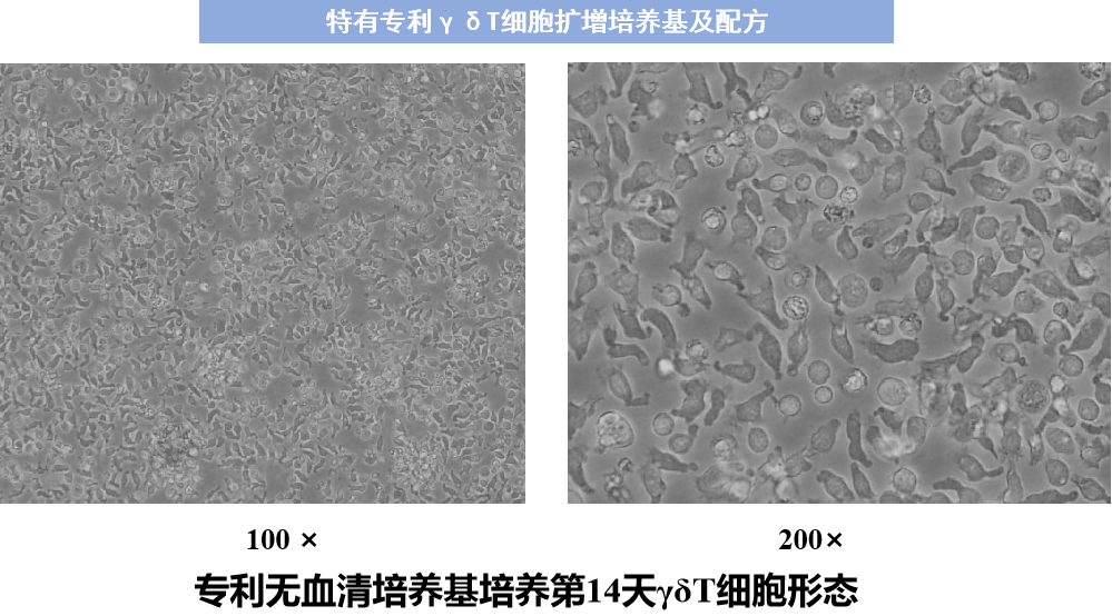 特有专利γδt细胞扩增培养基及配方:100ml外周血可以培养扩增到50亿