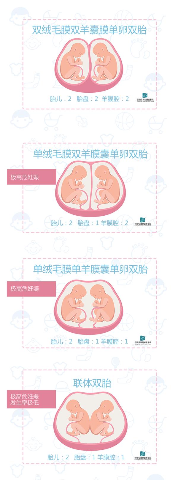 双胞胎有这几种类型,你知道几个? - 知乎