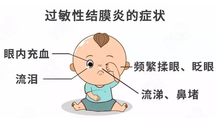 过敏性结膜炎该如何治疗呢