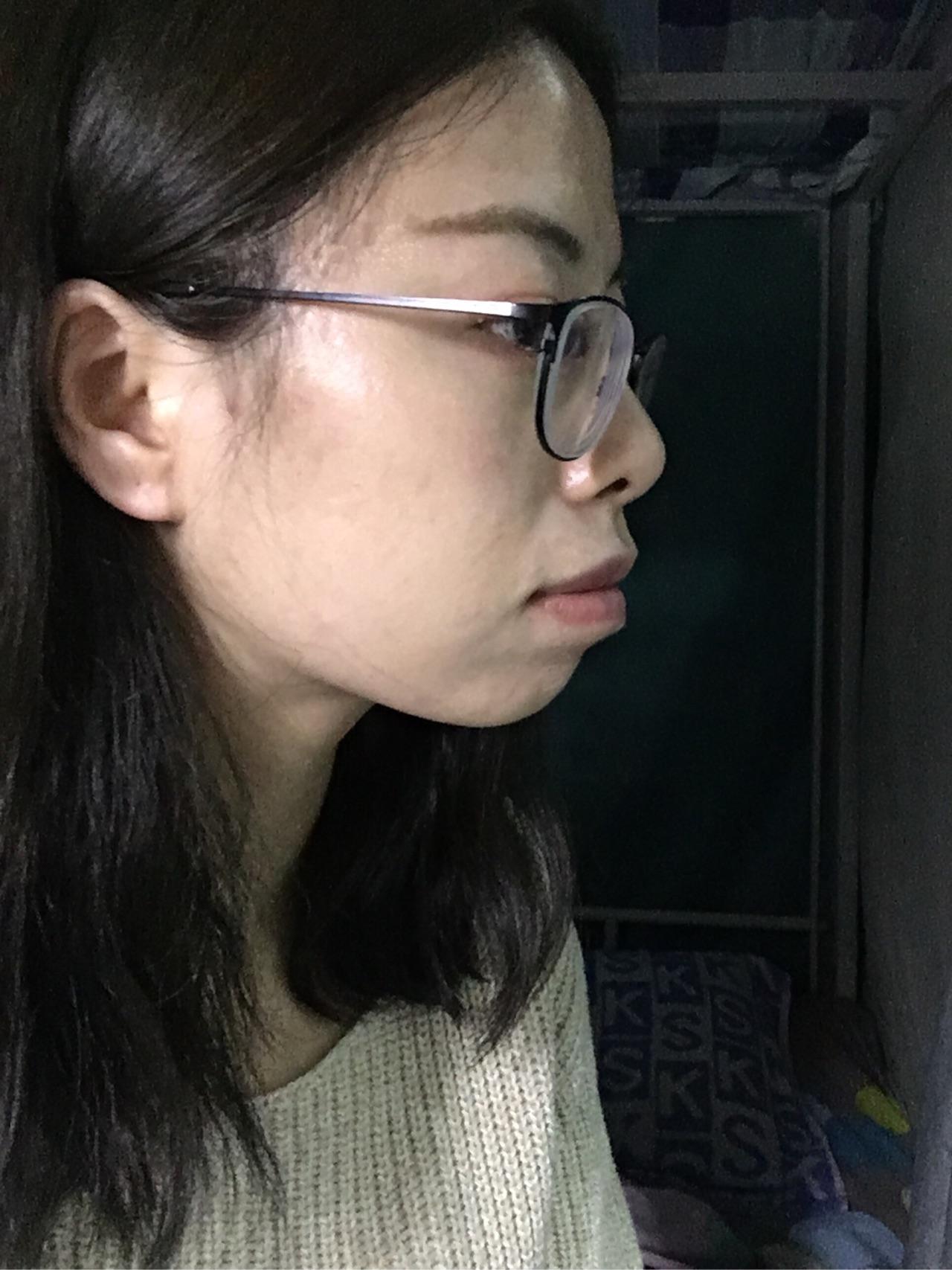 没下巴是怎样的体验