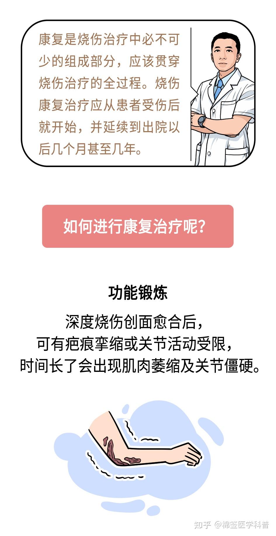烧伤后如何康复?看这篇就够了! - 知乎