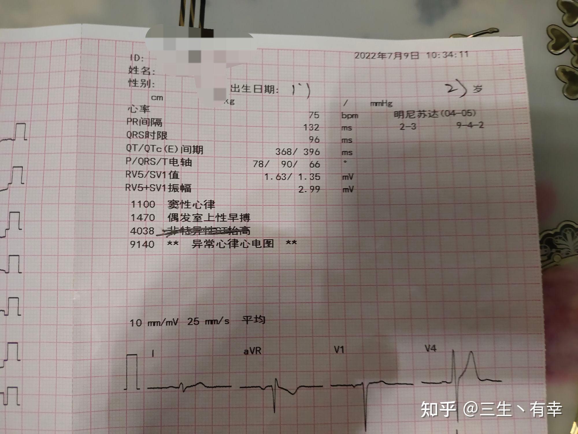 因为心电图被拒入职图片