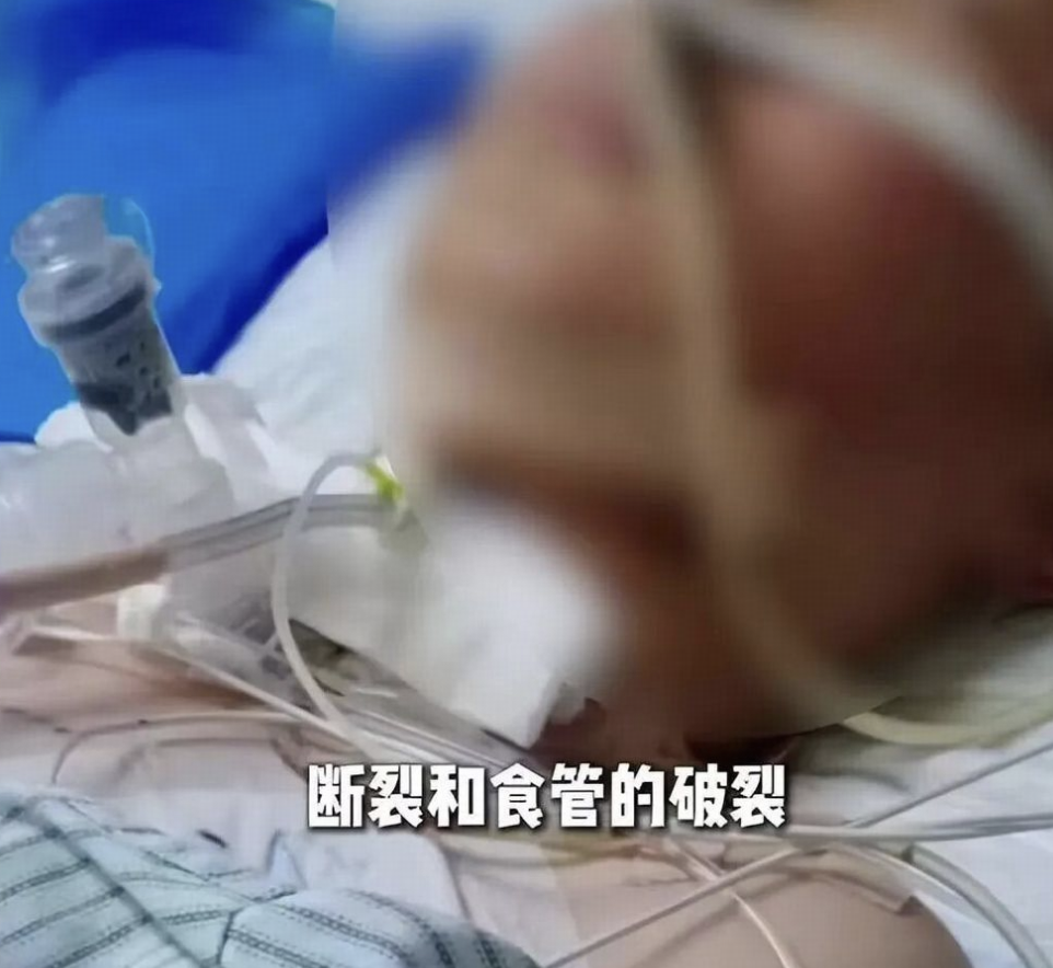 13 岁男孩骑车路上被绳索割喉，拉绳老人已被采取刑事强制措施，其将承担哪些法律责任？