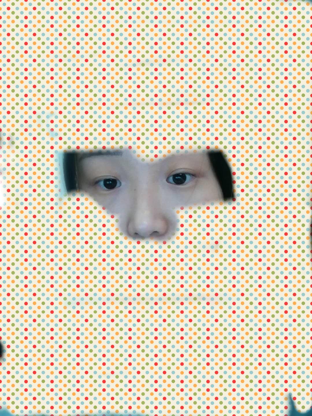 开眼角有什么后遗症? - 知乎