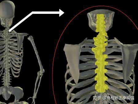 下图为胸椎小关节紊乱脊柱是一个相当柔软又能活动的结构,随着身体的