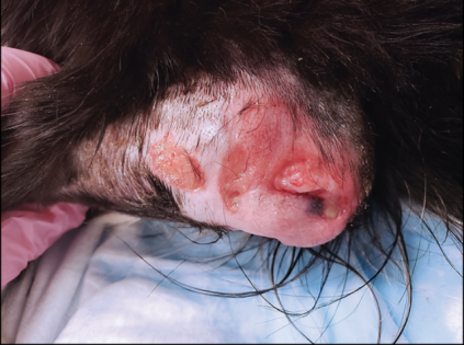 【软组织外科学】 肘部水囊瘤的保护装置