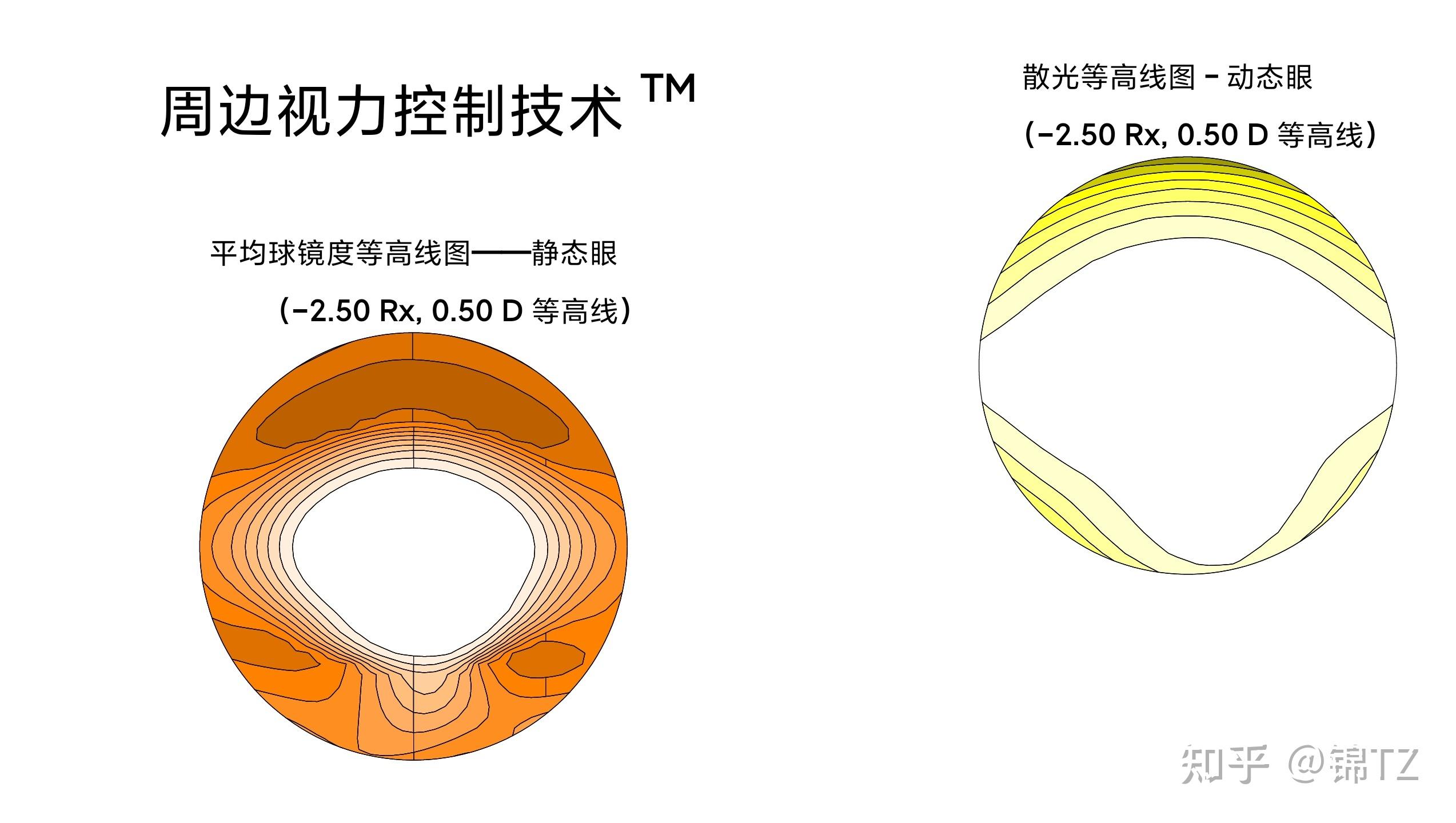 蔡司成长乐镜片原理图片