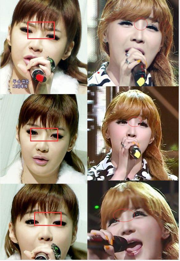 韩国有哪些明星做了明显的整容