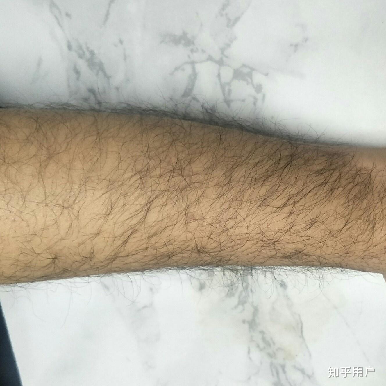 体毛多的原因到底是什么？ - 知乎