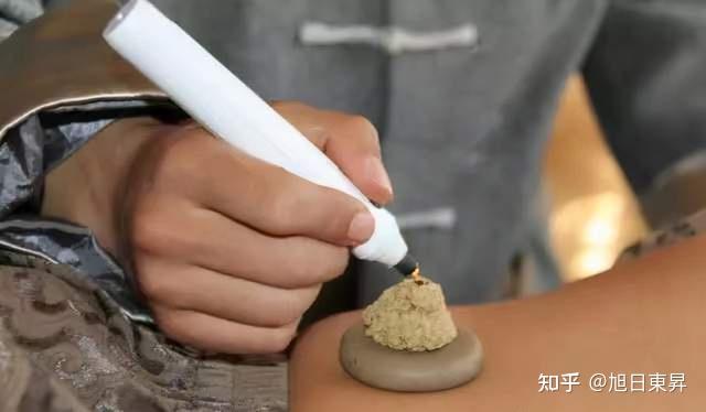 中间以针刺数孔,置于施术部位,上面再放艾炷灸之,当患者感觉灼痛时,则
