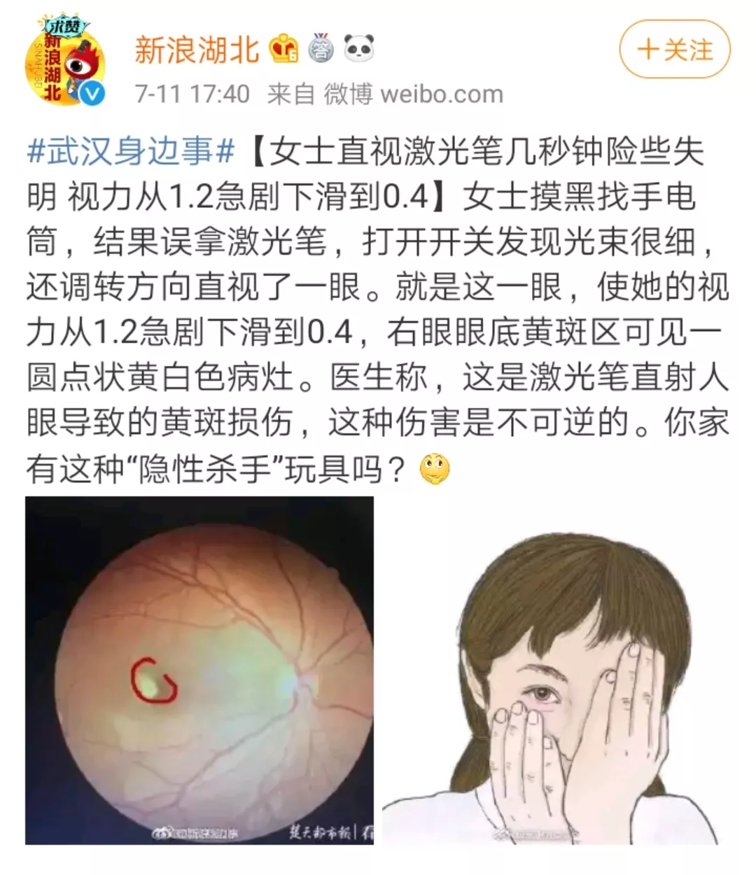 激光笔对眼睛的伤害有多大