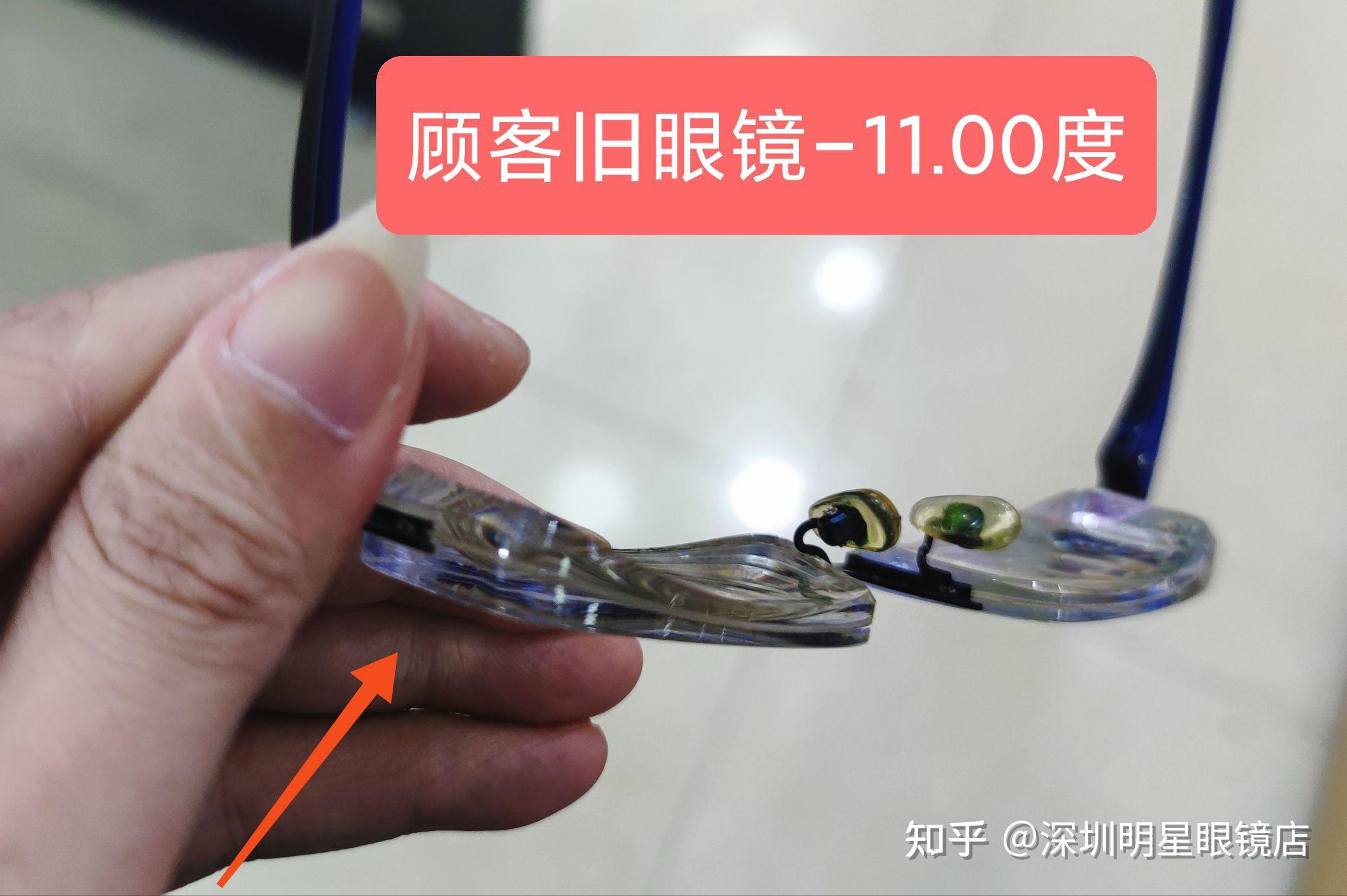 1000度以上的高度近视眼镜镜片一定是很厚很难看那种吗能不能不那么丑