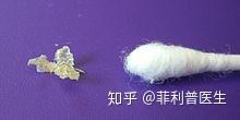 耳屎能大到什么程度? 2 v2 b11dbb93257889e12e2015182d00e371 720w