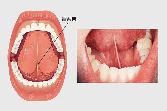 小孩子怎么练习舌头 v2-b1464b8343e1d1349eef72dc718b150b_1200x500.jpg