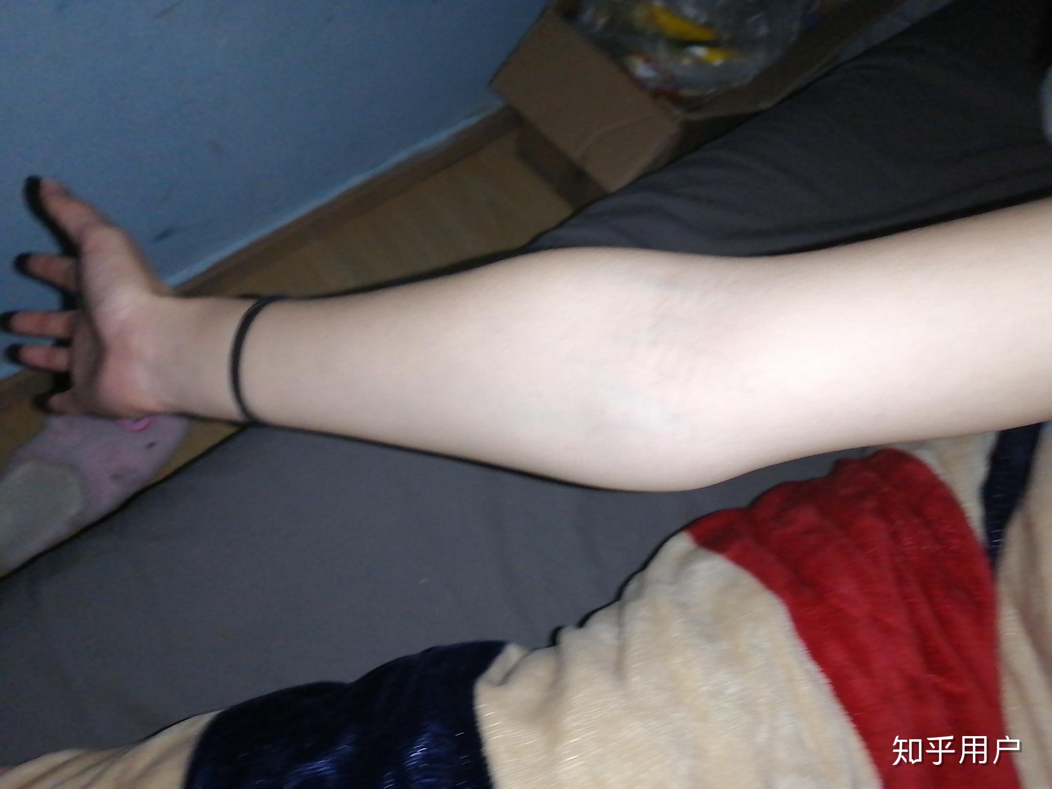 女生小臂粗,是肌肉型的,该怎么减啊? - 知乎