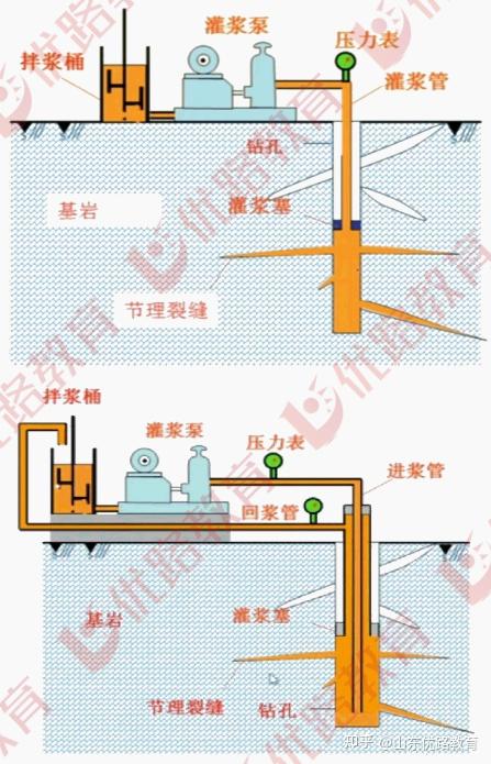 血液灌流安装图图片