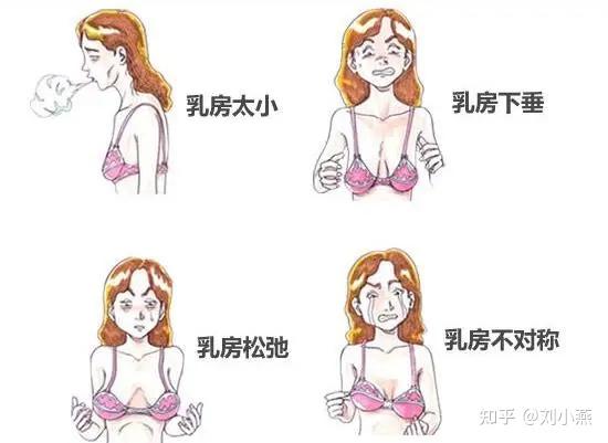 刘燕酿制:青春期的乳房发育 注意事项要了解 