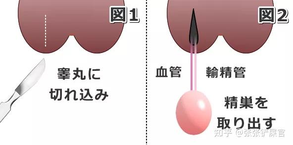 在沿着头发暴露包含睾丸的睾丸后