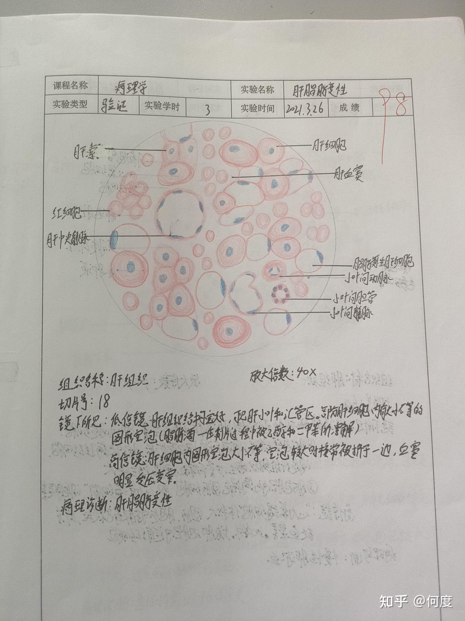 病理實驗 紅藍鉛筆繪圖 - 知乎