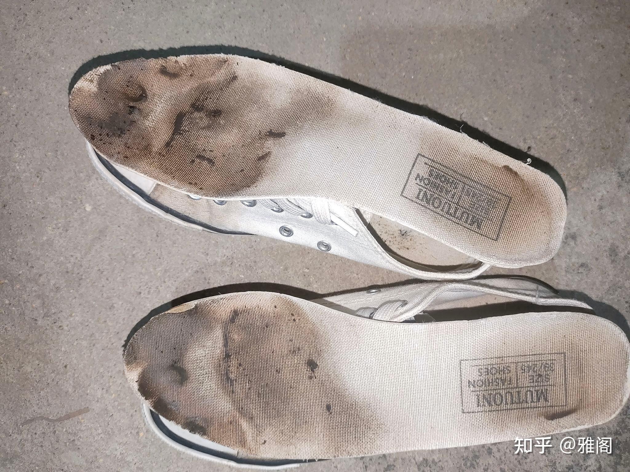 女孩子穿过的鞋垫有多脏?