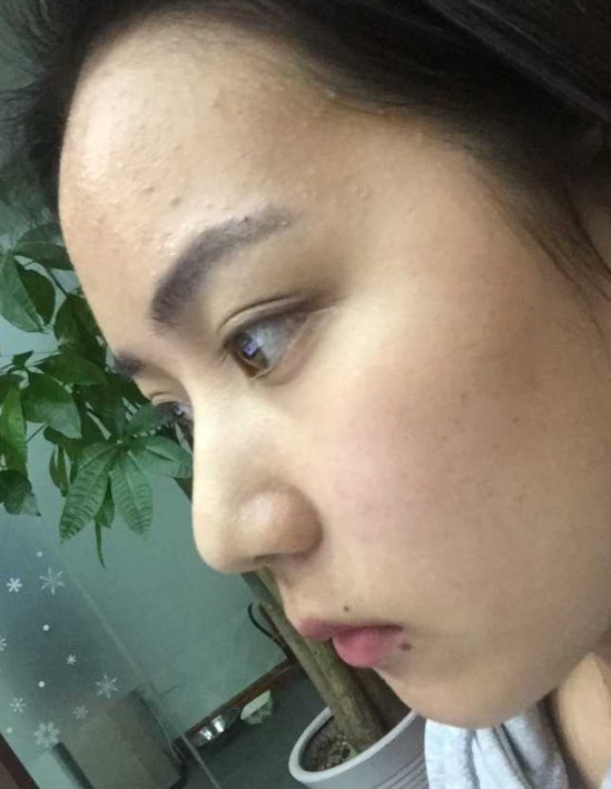 山根低鼻梁高是怎样的体验