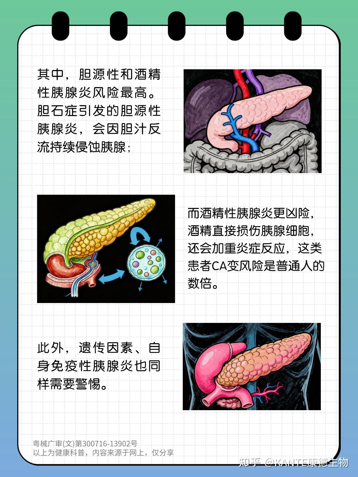 胰腺的“慢性炎”，拖久了会CA变吗？ - 知乎