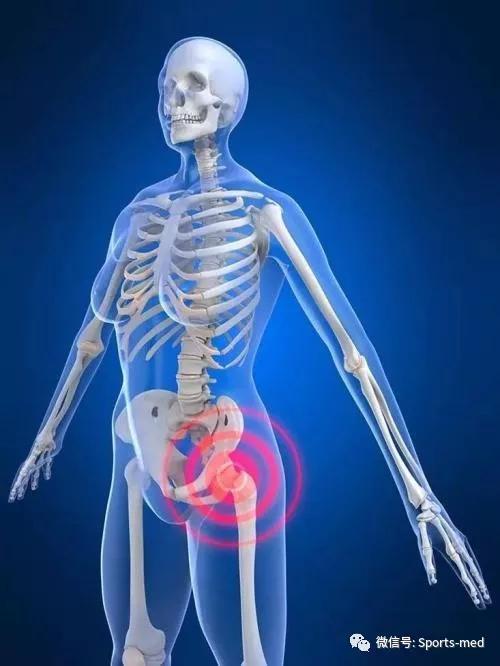 髋宽而谈运动医学宋斌医生