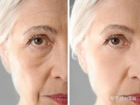 比起衰老,脸部下垂才更显老!想要延缓面部衰老试试这样做 - 知乎
