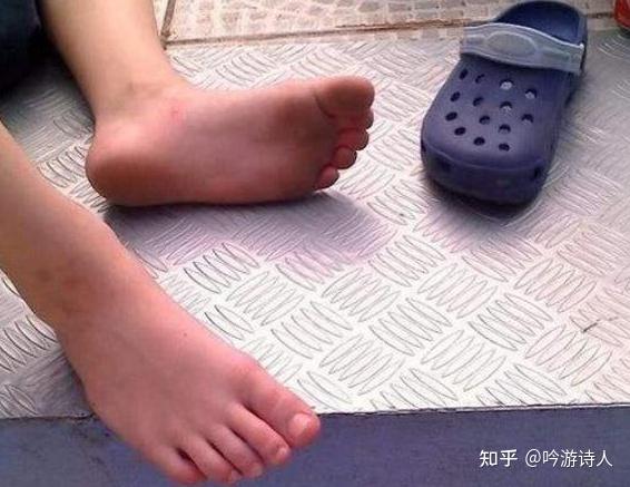 女生会脚臭吗