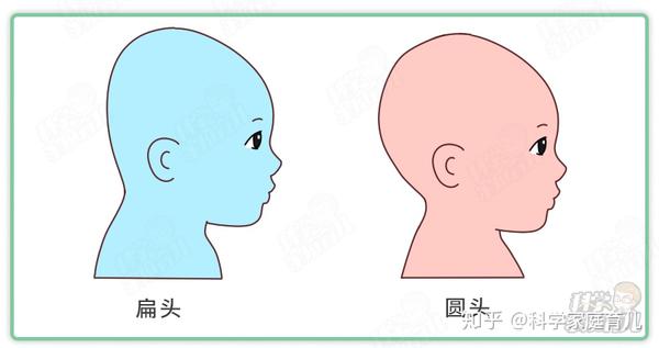 娃偏头、扁头会伴随一生?专家:千万别错过矫正“黄金期” - 知乎