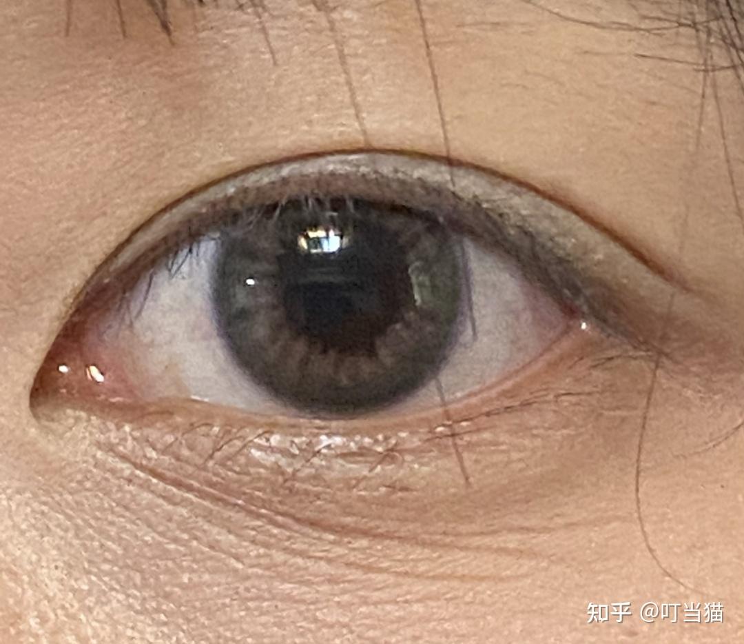 有什么办法可以预防眼角细纹
