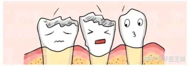 牙齿烂的只剩下残冠残根怎么办? - 知乎