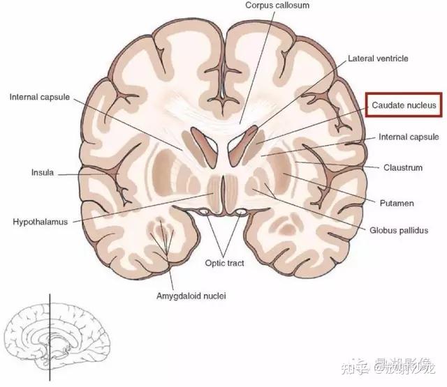 基底节的详细解剖 - 知乎