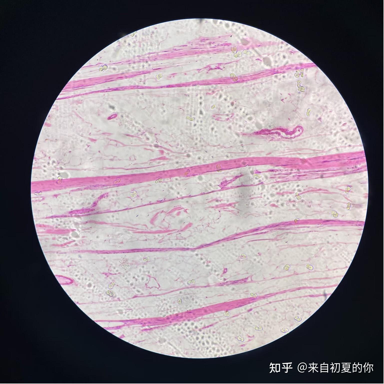 病理学切片图