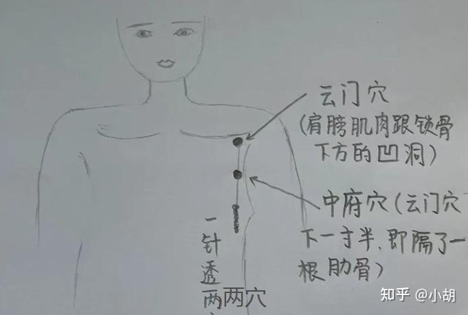 倪海厦针灸课笔记(8)手太阴肺经 - 知乎