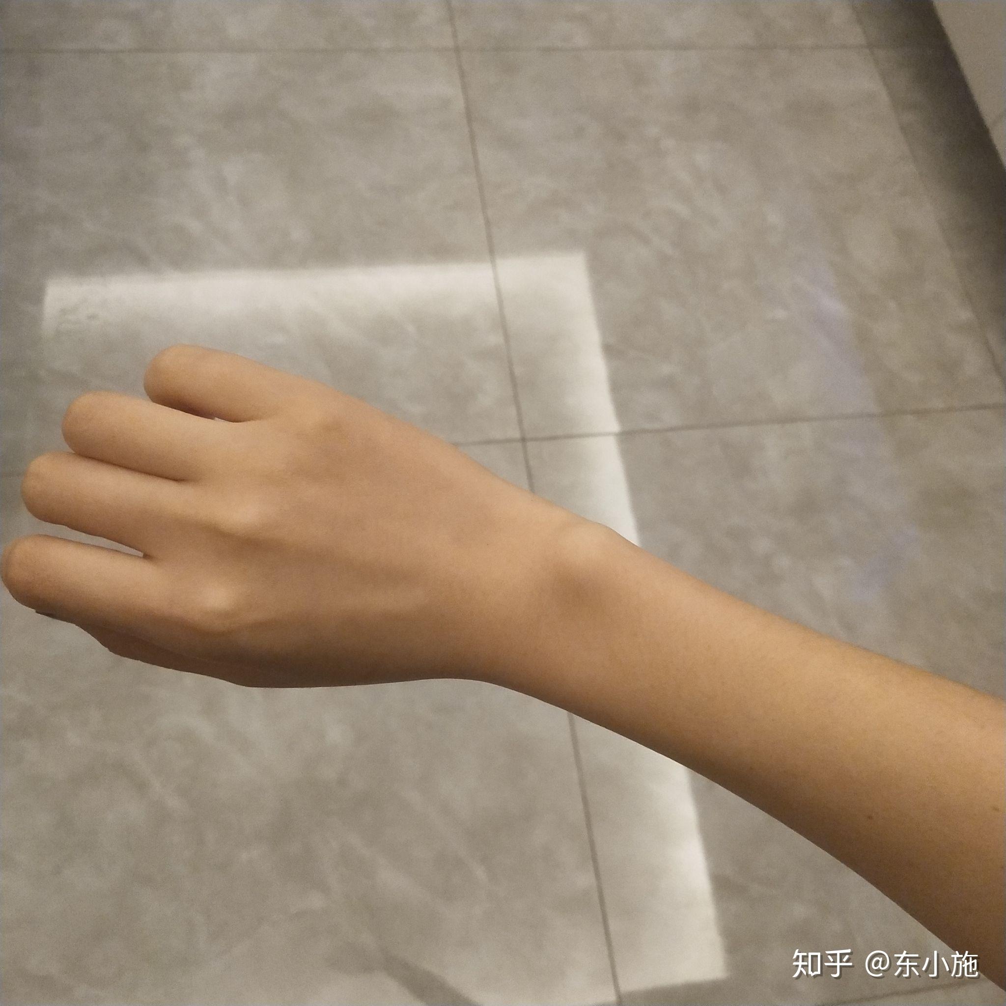 你见过最细的手腕是多细