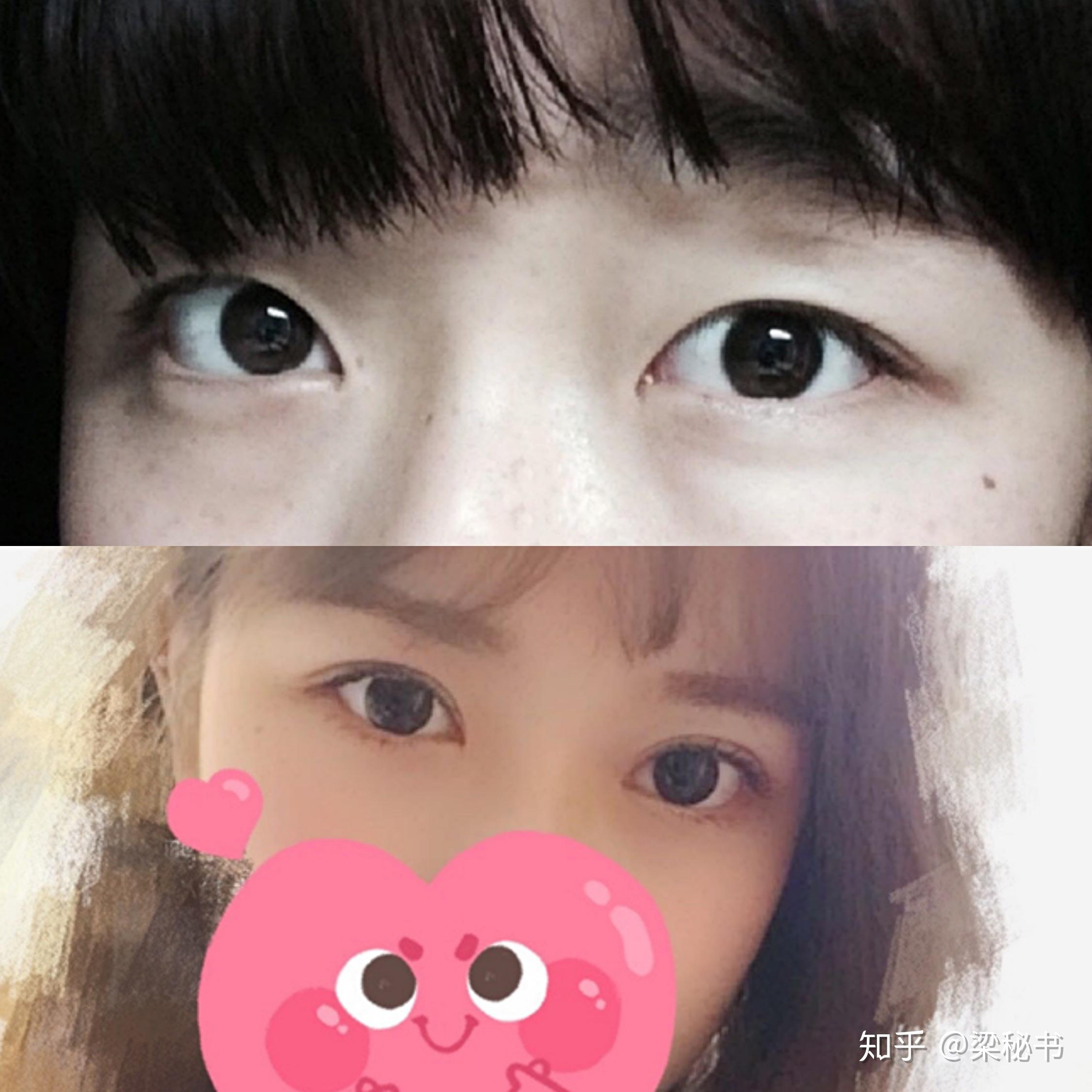 内双是怎样一种体验? - 知乎