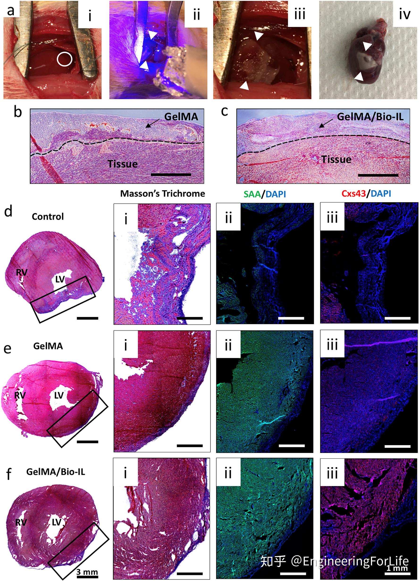 图4 利用小鼠心肌梗死模型对gelma/bio