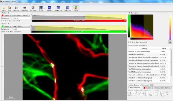 使用imaris对激光共聚焦照片进行体积测量及共定位分析 知乎