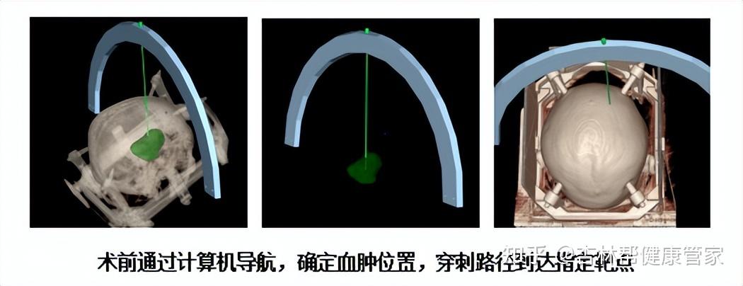中日友好医院健康管家CT加急-中日友好医院健康管家ct加急多少钱 