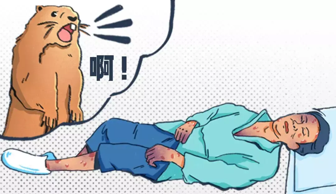 鼠疫究竟有多可怕? - 知乎