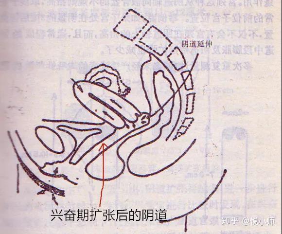 巫山云雨时阴道放屁就是阴道松了