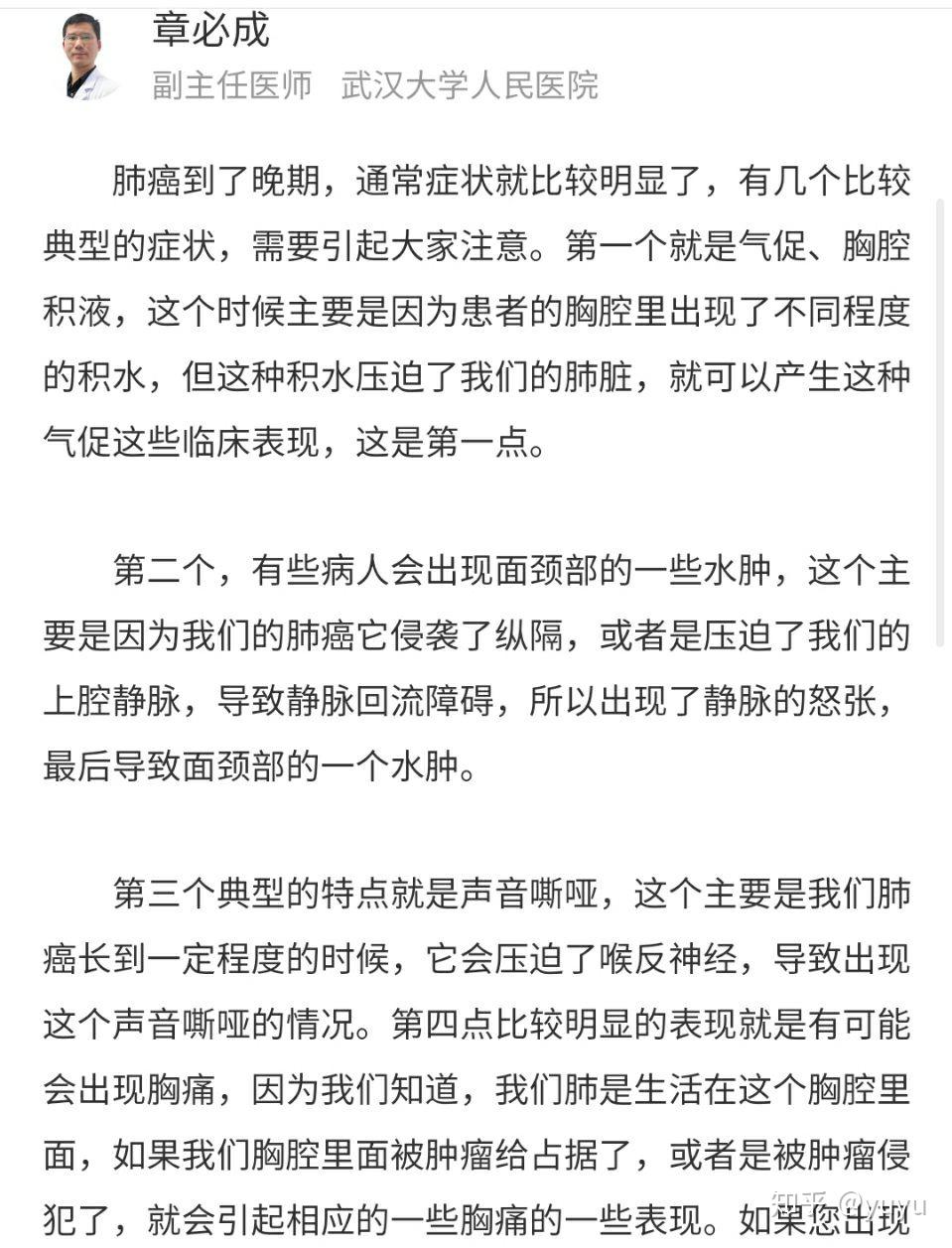 如何评价b站up主卡夫卡松饼君