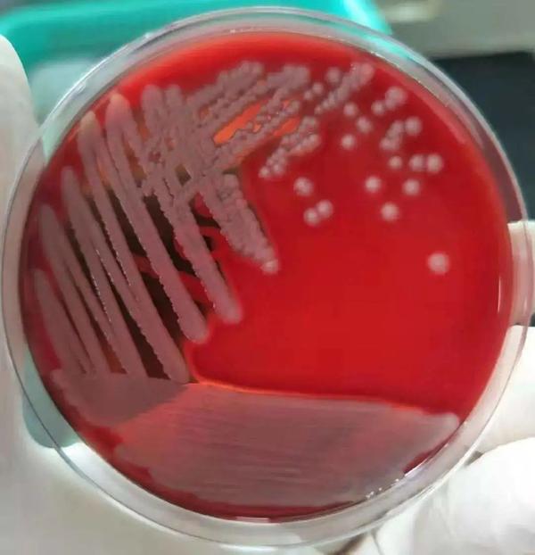 金黄色葡萄球菌微生物菌落形态特征 - 知乎